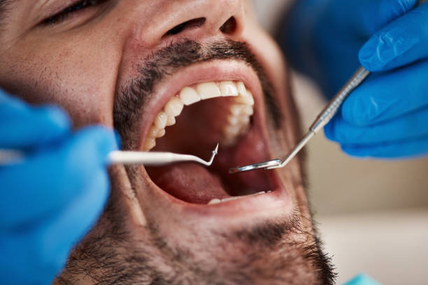 Best TMJ/TMD Treatment  in Milan, IN